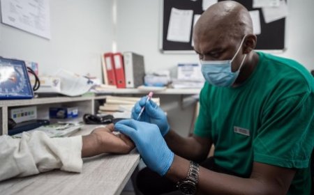 Elimination de la pandémie du SIDA à l’horizon 2030 : Le nombre de décès a baissé de 70% de 2010 à fin 2022