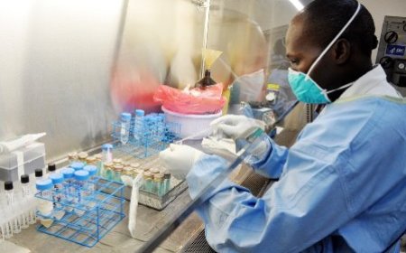 Lutte contre la tuberculose : cette maladie ne doit plus être un problème de santé publique à l’horizon 2030