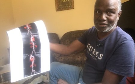 Santé cardiaque / Diabagaté Seydou, patient guéri d'un anévrisme, révèle : « La médecine et la technologie m’ont donné une seconde vie. »