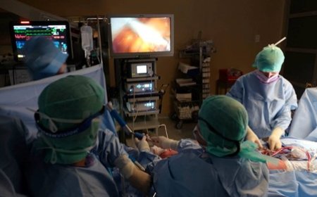 Santé cardiaque : La chirurigie vasculaire, une technologie innovante disponible en Cote d’Ivoire