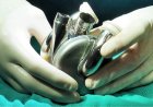 Première mondiale: Un patient survit 105 jours avec un cœur en titane