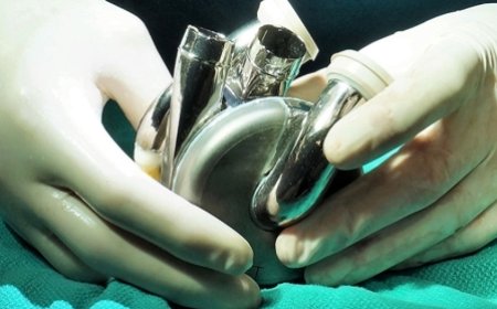 Première mondiale: Un patient survit 105 jours avec un cœur en titane
