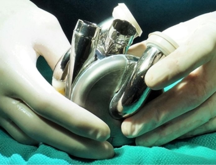 Première mondiale: Un patient survit 105 jours avec un cœur en titane
