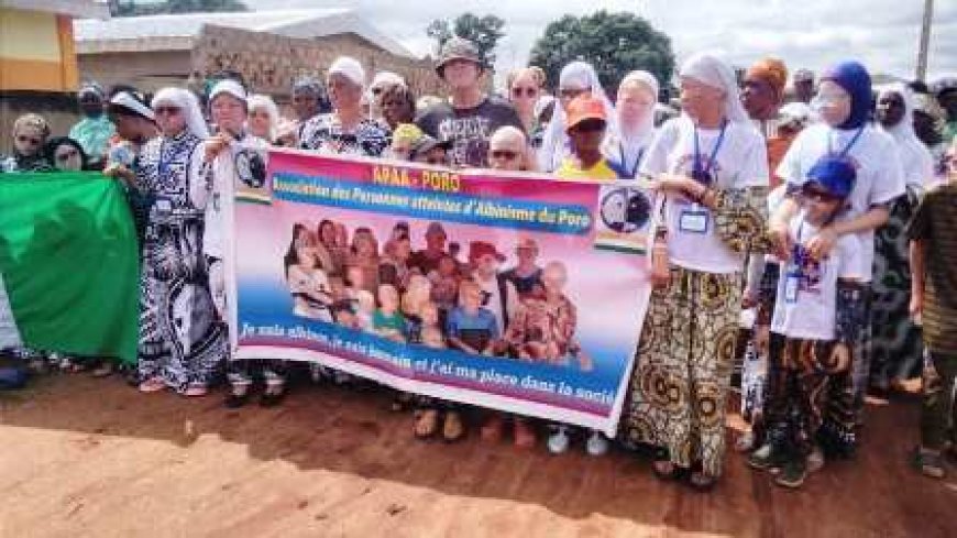 Korhogo : La Journée Internationale de l’Albinisme célébrée sous le signe du plaidoyer et de la solidarité