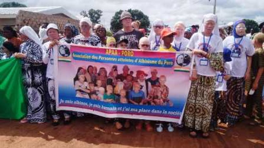 Korhogo : La Journée Internationale de l’Albinisme célébrée sous le signe du plaidoyer et de la solidarité