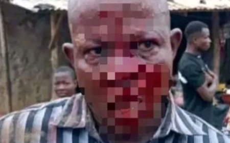 IEPP Tiassalé 2 : Un directeur d’école sauvagement agressé à la machette