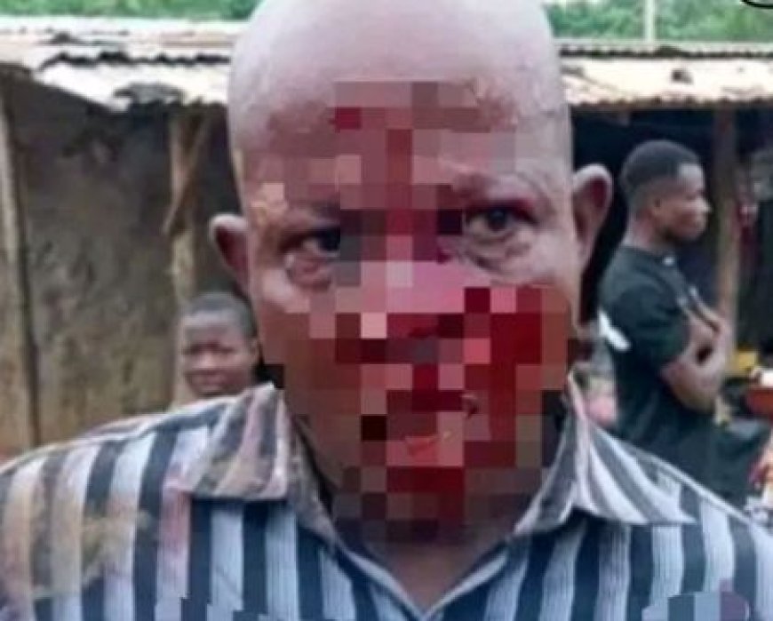 IEPP Tiassalé 2 : Un directeur d’école sauvagement agressé à la machette