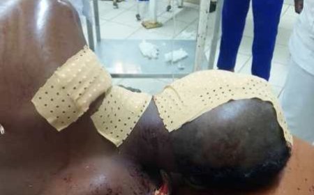 Korhogo : Un chauffeur de moto-taxi grièvement blessé, un agresseur condamné à 20 ans de prison