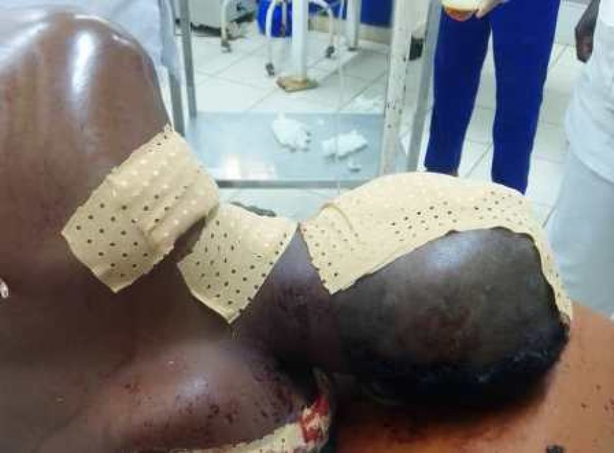 Korhogo : Un chauffeur de moto-taxi grièvement blessé, un agresseur condamné à 20 ans de prison