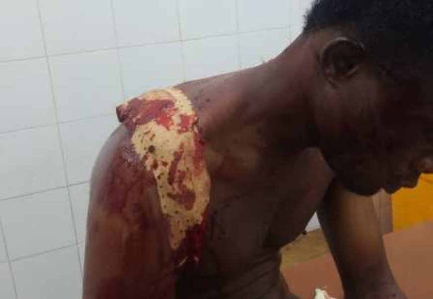 Korhogo : Un chauffeur de moto-taxi grièvement blessé, un agresseur condamné à 20 ans de prison