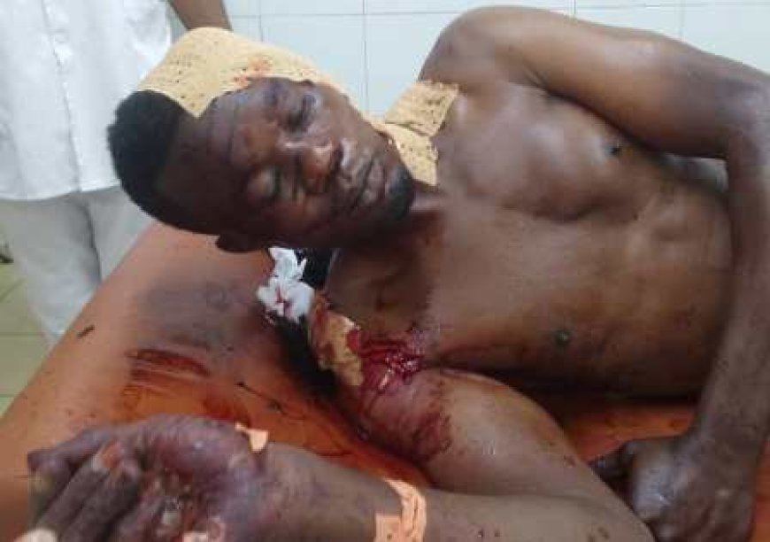 Korhogo : Un chauffeur de moto-taxi grièvement blessé, un agresseur condamné à 20 ans de prison