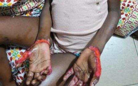 Yopougon : Une mère réclame justice pour sa fille de 6 ans après des faits présumés de brûlures à Abidjan